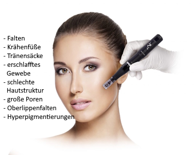 Micro Needling Pro